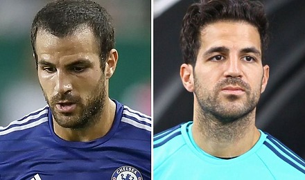 Cesc F&agrave;bregas Hair Transplant