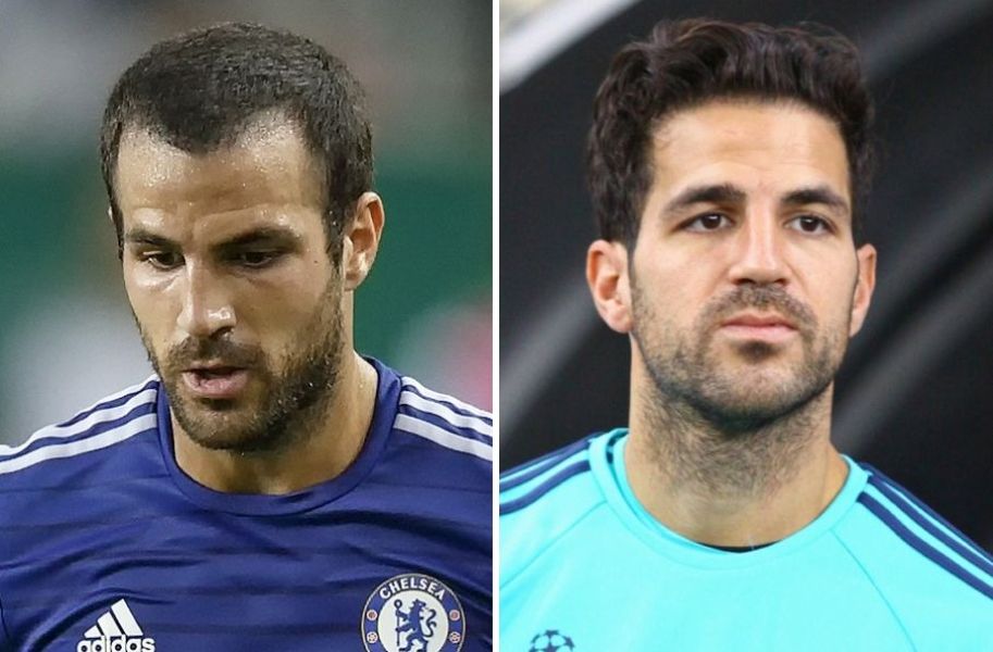 Cesc F&agrave;bregas hair transplant