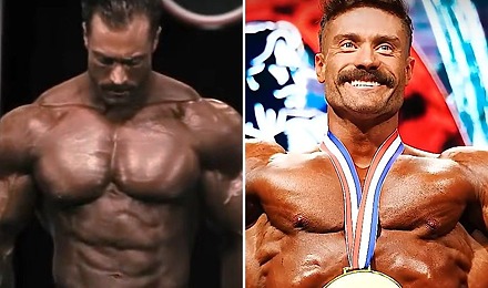 Chris Bumstead&rsquo;s Hair Transplant - The Full Scoop