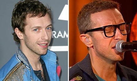 Chris Martin&rsquo;s Hair Transplant: Are The Rumours True?