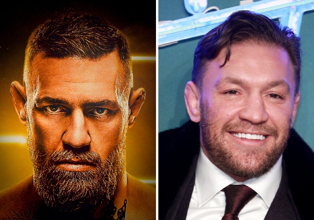 Did Conor McGregor&rsquo;s Hair Transplant Happen (And Fail)