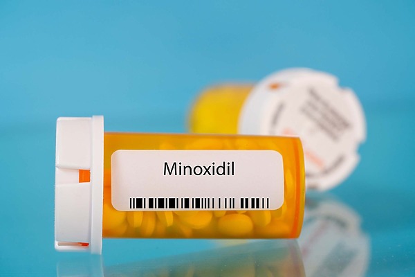 Is Oral Minoxidil Safe For Long-Term Use Against Hair Loss?