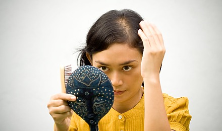 Hair Loss Women 20s