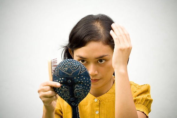 hair loss women 20s