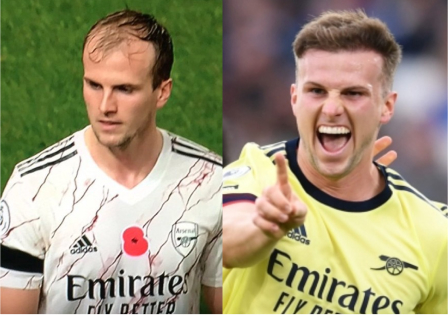 Before and after hair transplant