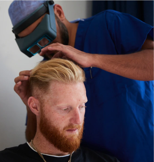 Doctor checking patient after hair transplant