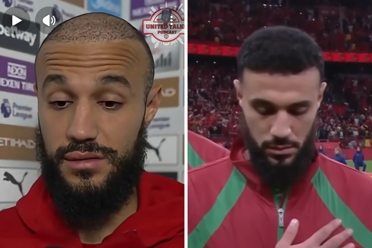 mazraoui days & 4 months after hair transplant
