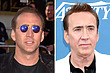 Celebrity Hair Transplant