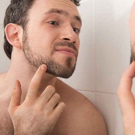 beard transplant turkey featured image
