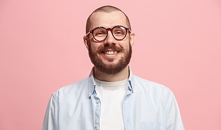 Going Bald At 30