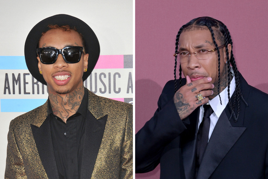 Tyga Hair Transplant Featured Image