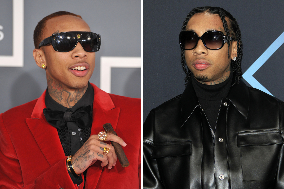 Left: Tyga&rsquo;s hairline in 2012. Right: Tyga&rsquo;s post-transplant hairline in 2018.