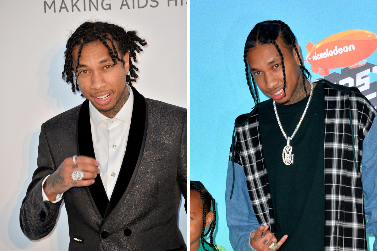 Tygas hairline in 2018-2019