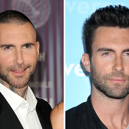 adam levine hair transplant