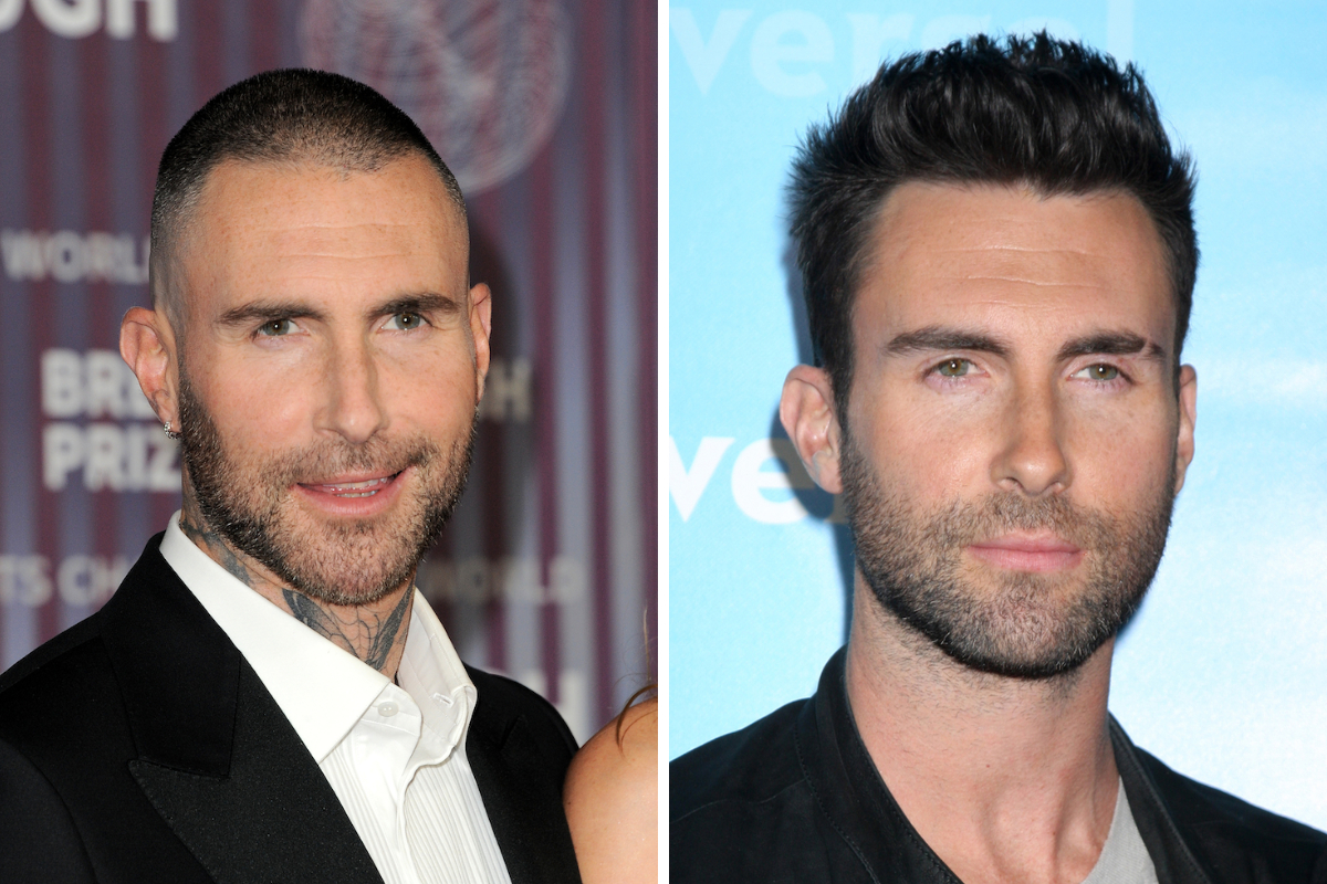 adam levine hair transplant