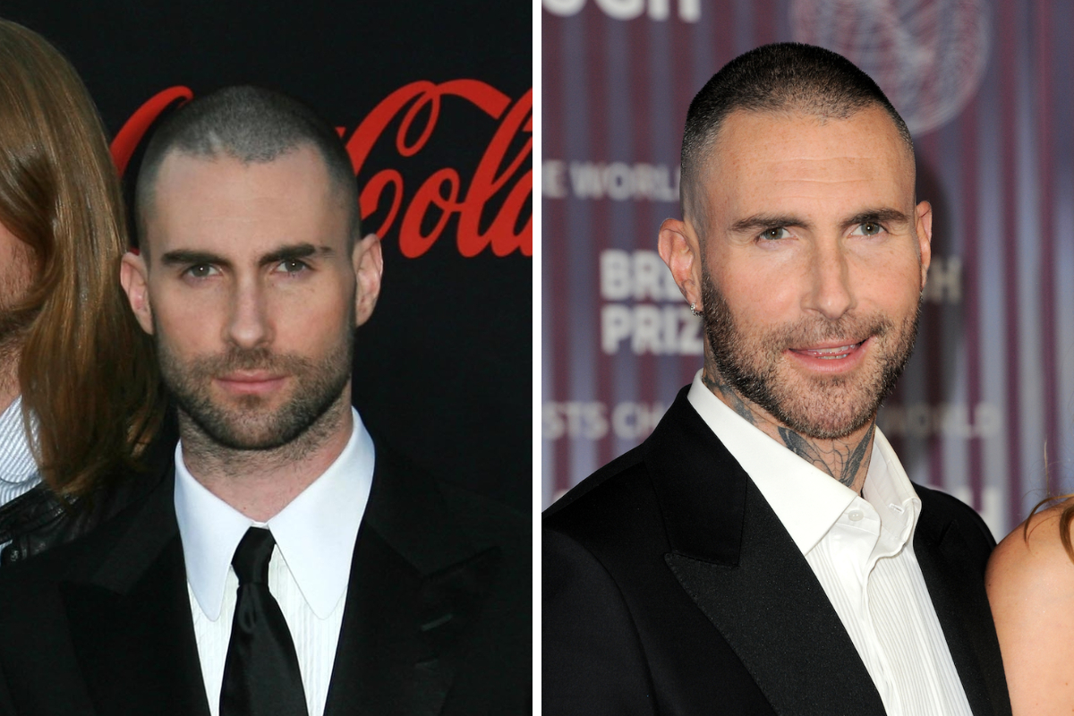 adam levine hairline scar