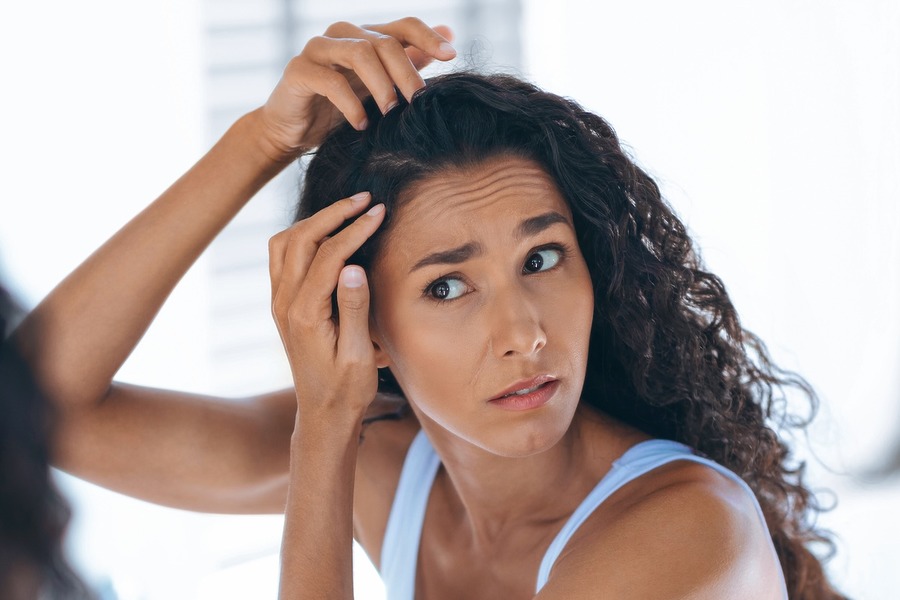 Are Baby Hairs A Sign Of Balding Featured Image