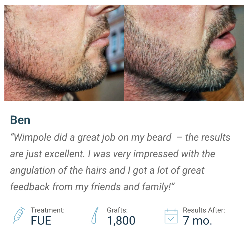 ben beard transplant case study details