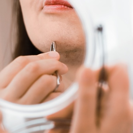 minoxidil hypertrichosis