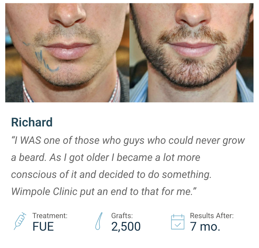 richard beard transplant case study details