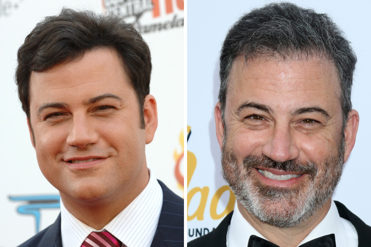 jimmy kimmel hairline in 30s vs 50s