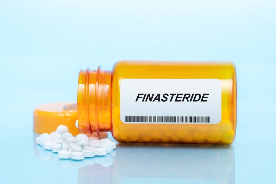 Finasteride NHS