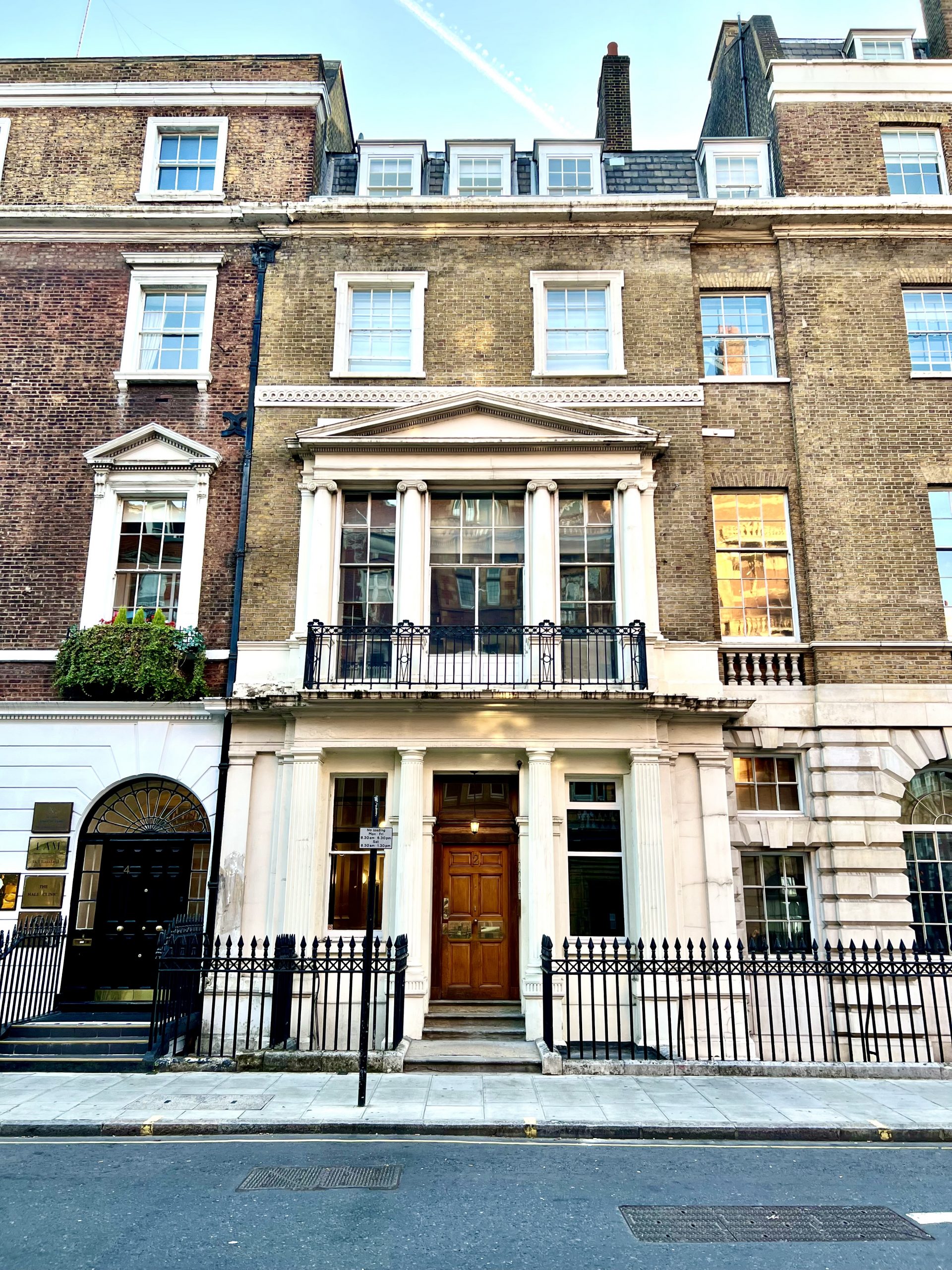 Hairline Transplant, Wimpole Clinic