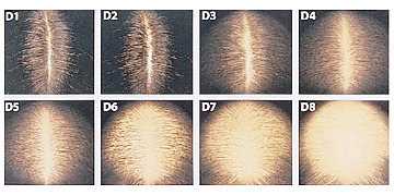 Savin Scale Examples Normal Hair Parting Width vs Thinning: Causes and Treatments