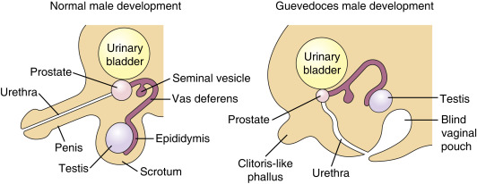 Sexual differentiation and development in a normal male at birth and a male with 5&alpha;-reductase deficiency