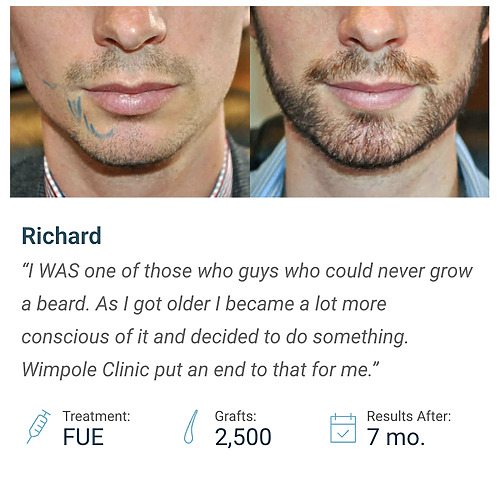 richard beard transplant case study details